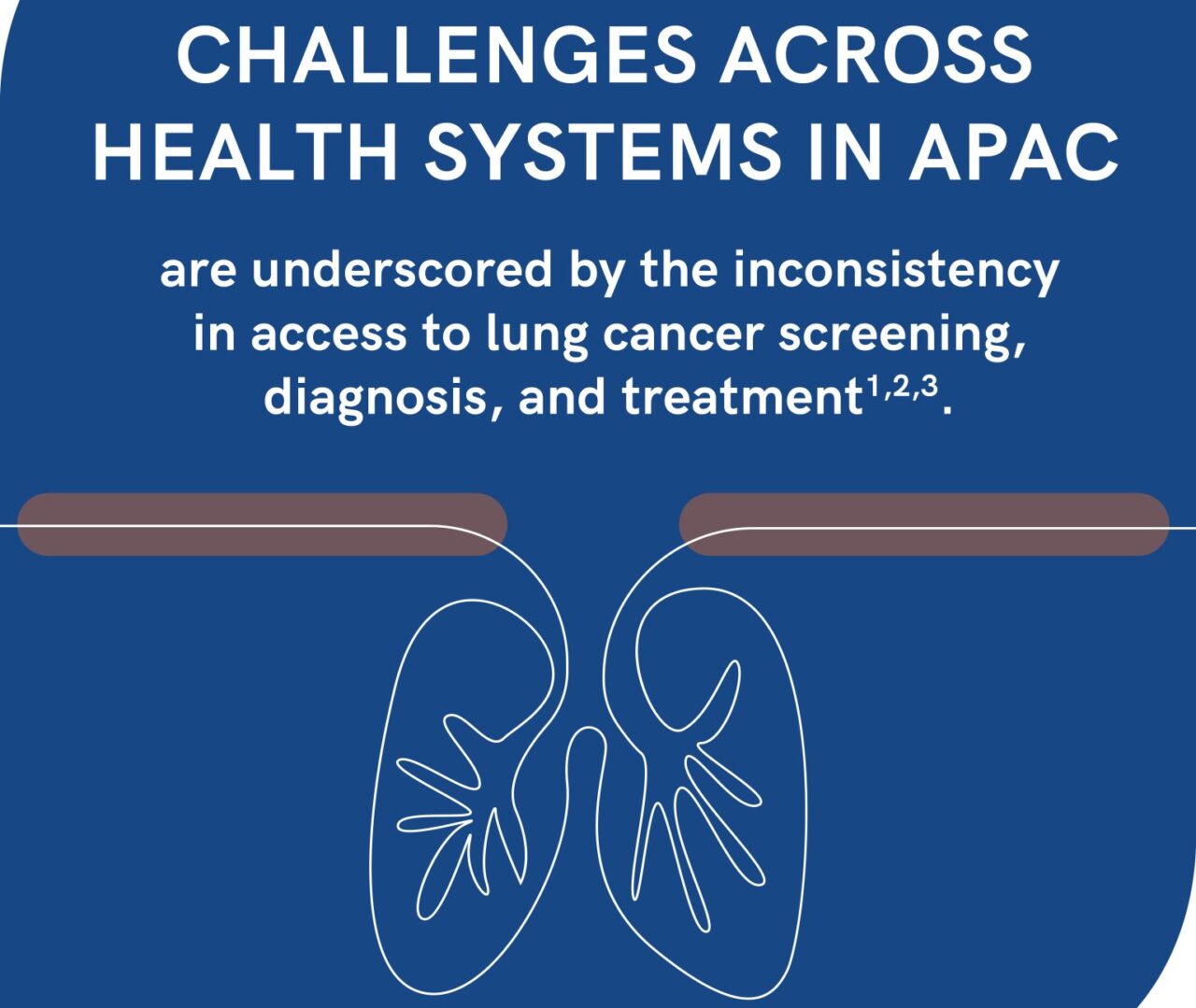 Explore challenges of lung cancer prevention in this infographic series – ASPIRE for Lung Cancer