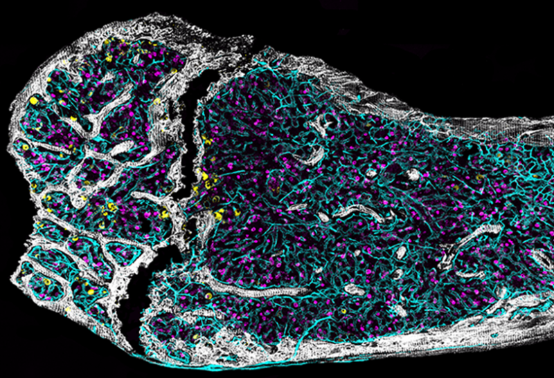 Jennifer Trowbridge: Delighted that Kira Young’s work made the cover of Blood Journal!