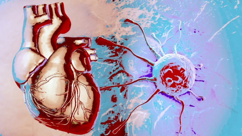 Eric H. Yang: Interesting study from cardio-oncology IRAEs