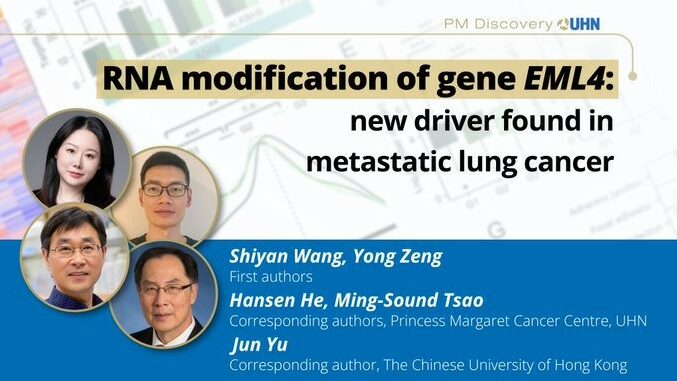 A Novel Driver of Metastasis in Lung Cancer – Princess Margaret Centre Research