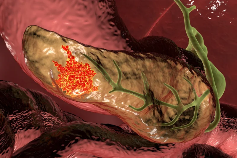 Anirban Maitra: Spatial organization of cancer – It’s all about the niches and neighborhoods