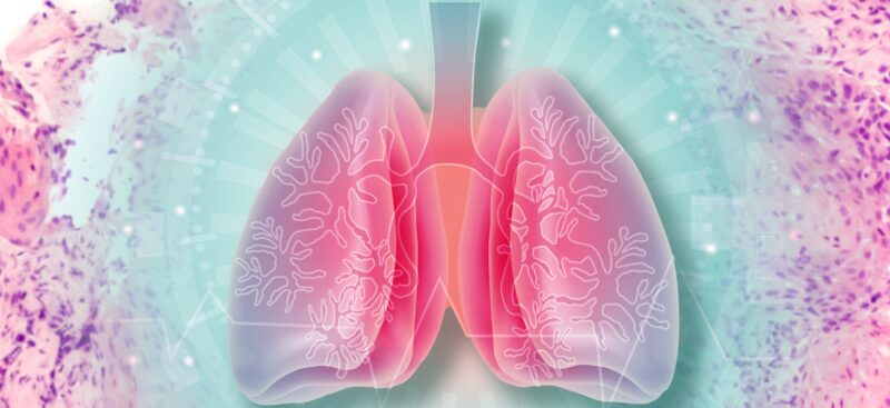 Jill Barnholtz-Sloan: New way to map whole tissue slides