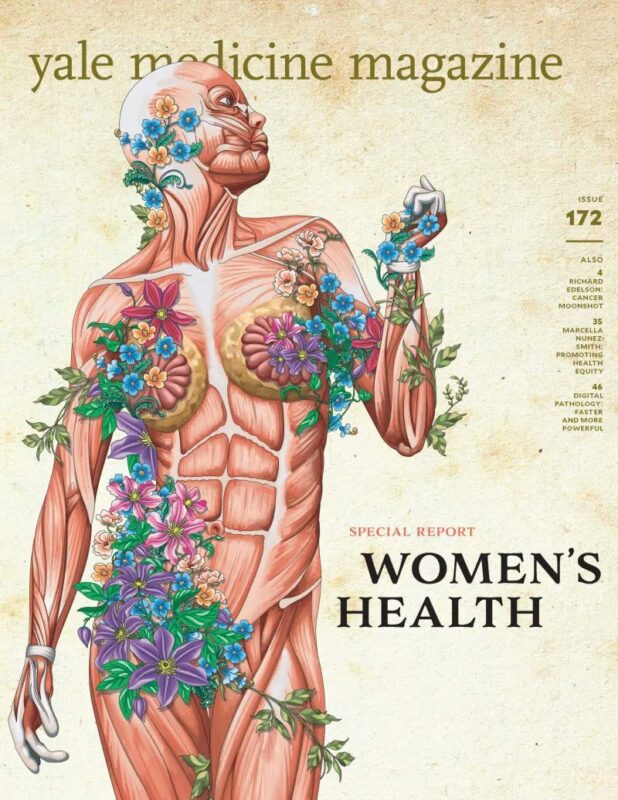 Special issue on progress in breast cancer care In Yale Medicine Magazine – Yale Cancer Center