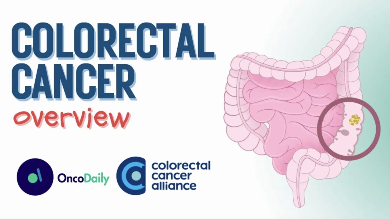 What 99% of people don’t know about Colorectal Cancer
