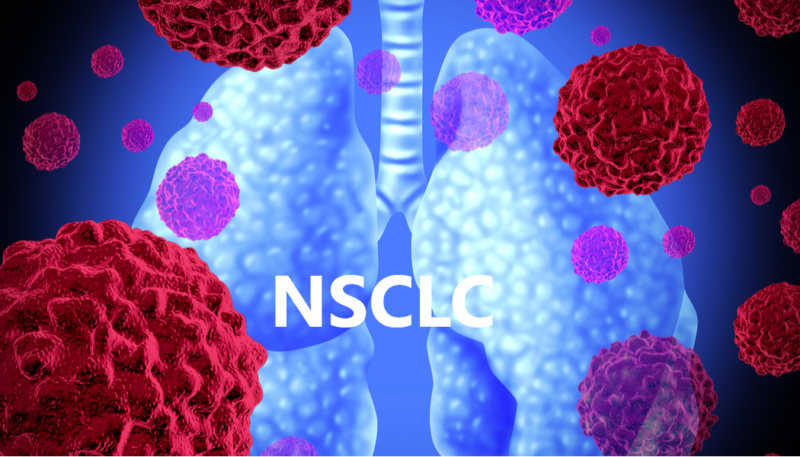 Stephen Liu: Phase III SKYSCRAPER-01 study is negative for OS at final analysis