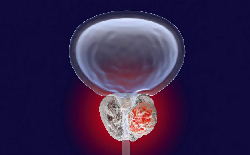 Heterogeneity of the Treatment Effect with PARP Inhibitors in Metastatic Castration-resistant Prostate Cancer