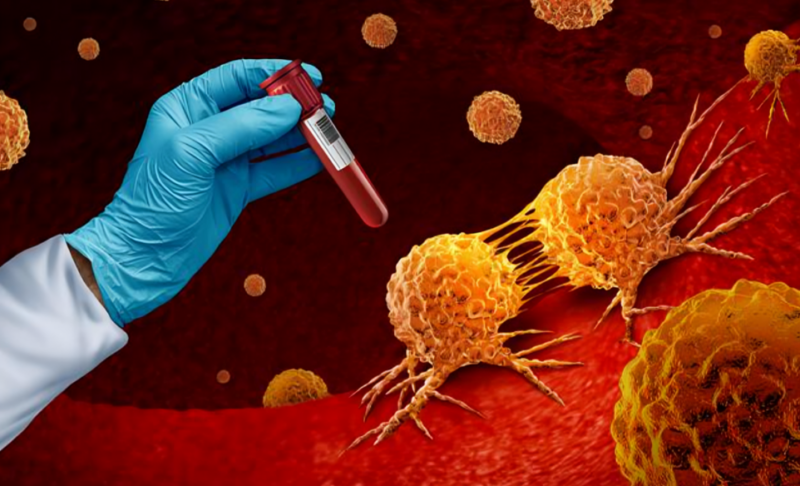 Brendon Stiles: Neoadjuvant chemo-ICI in marginally resectable patients