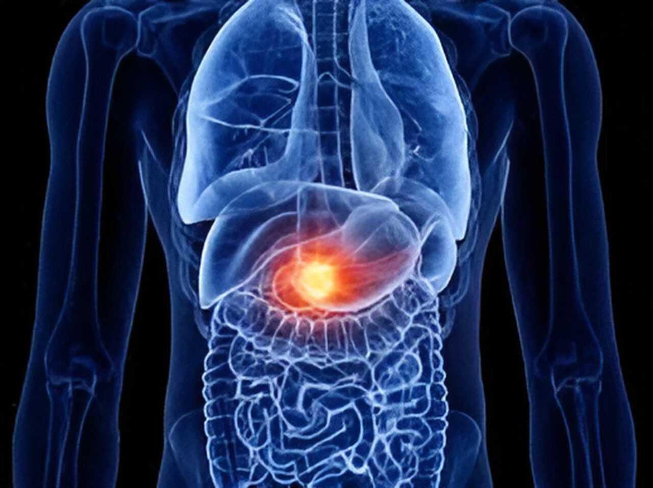 Johns Hopkins scientists training AI to improve early detection rates of pancreatic cancer