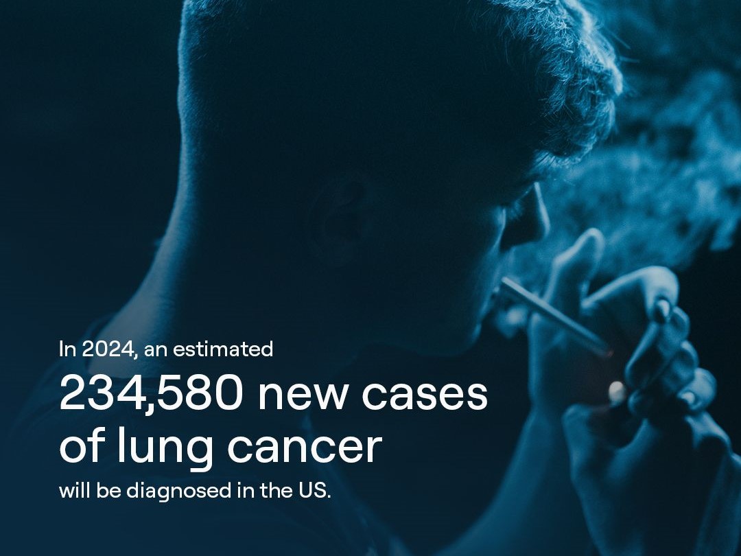 How Genomate is paving the way for more precise, effective lung cancer treatments