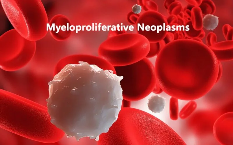 Gary Reuther: SHP2 may be a therapeutic target for patients with MPNs