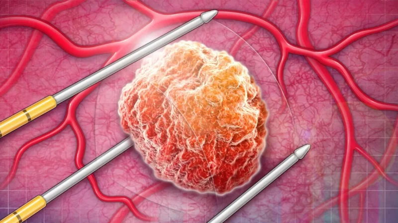 MRI PI-RADS Score and Prostate Cancer Active Surveillance Early Biopsy Reclassification