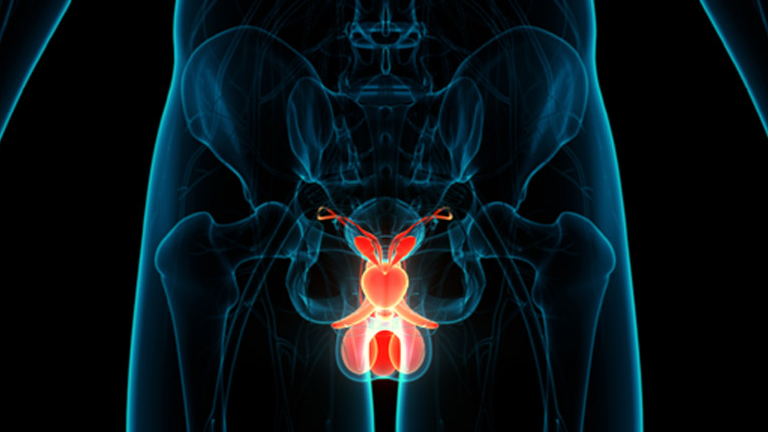 Study on circulating tumor cell counts in prostate cancer – Advanced Prostate Cancer Consensus Conference