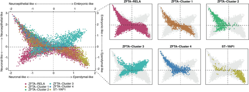 Daeun Jeong: Cell-intrinsic and extrinsic factors underlying malignancy in supratentorial ependymomas