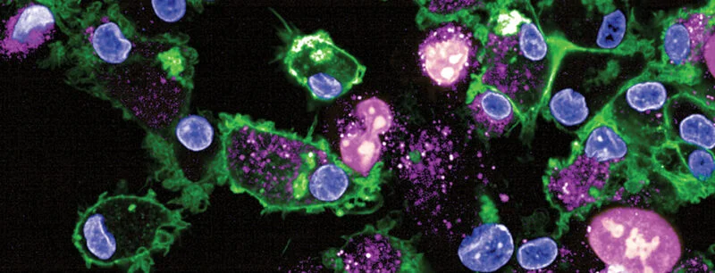 Register for the EORTC-NCI-AACR Symposium on Molecular Targets and Cancer Therapeutics