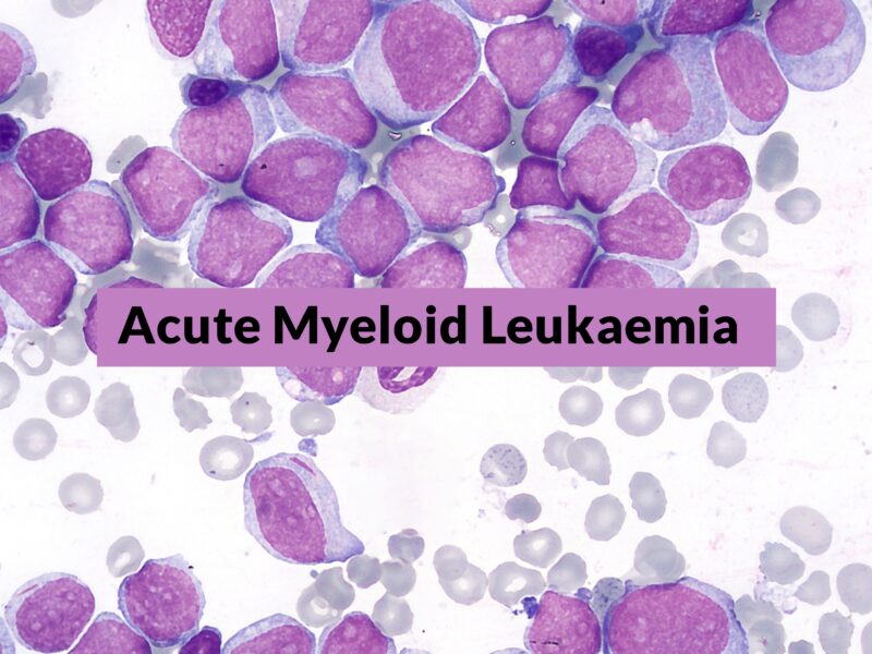 New ELN classification of AML receiving less intense therapies