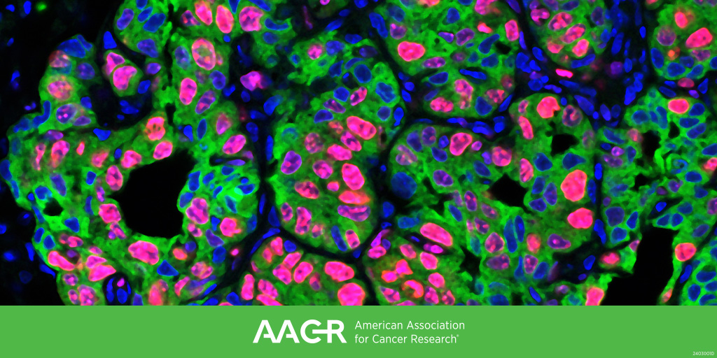 Abstract submission for the AACR conference on Tumor-body Interactions