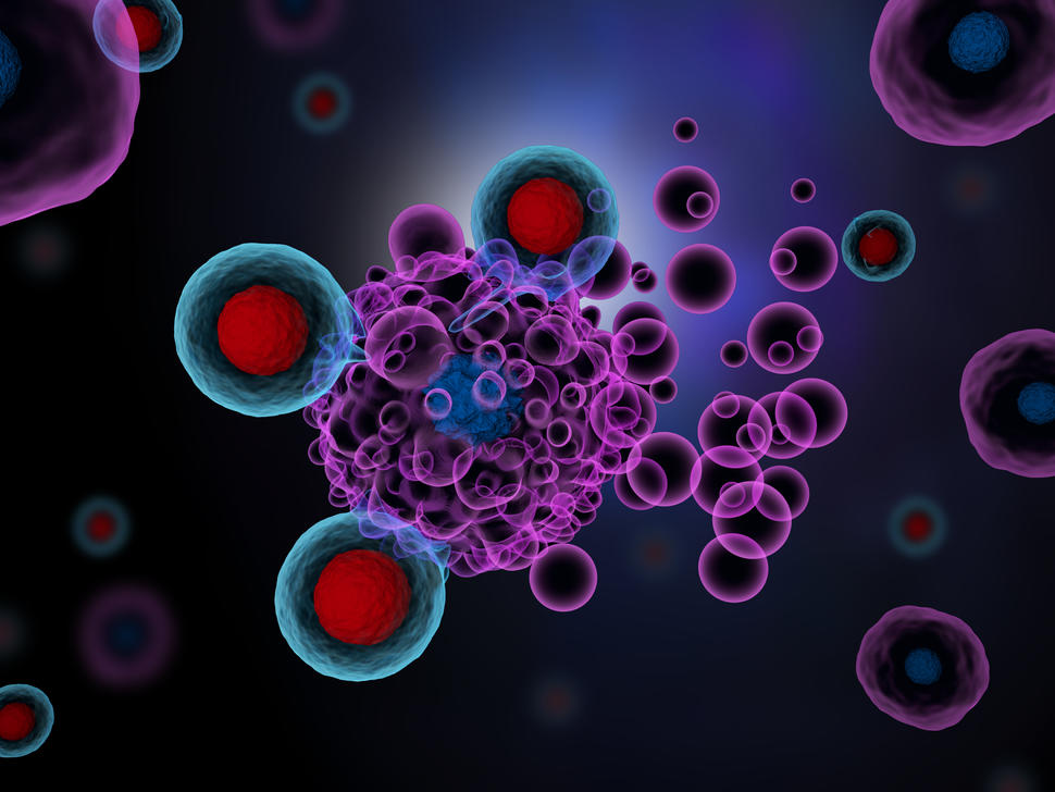 Hematology Omission of Radiotherapy in Primary Mediastinal B-Cell Lymphoma