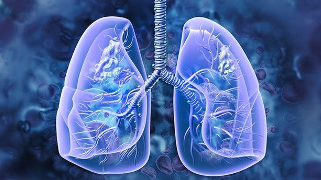 Lung-MAP Next Generation Sequencing Analysis of Advanced Squamous Cell Lung Cancers