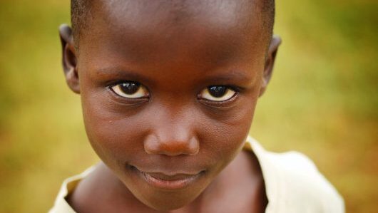 Some facts about Childhood Cancer in Uganda – Uganda Cancer Institute