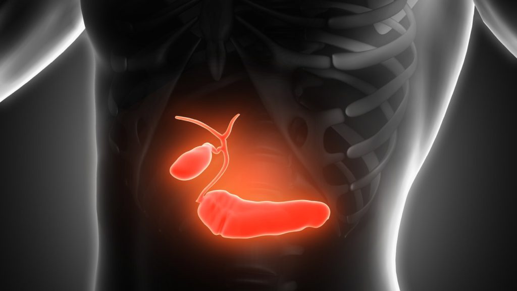 Activity of T-DXd in HER2-expressing Biliary Tract Cancer