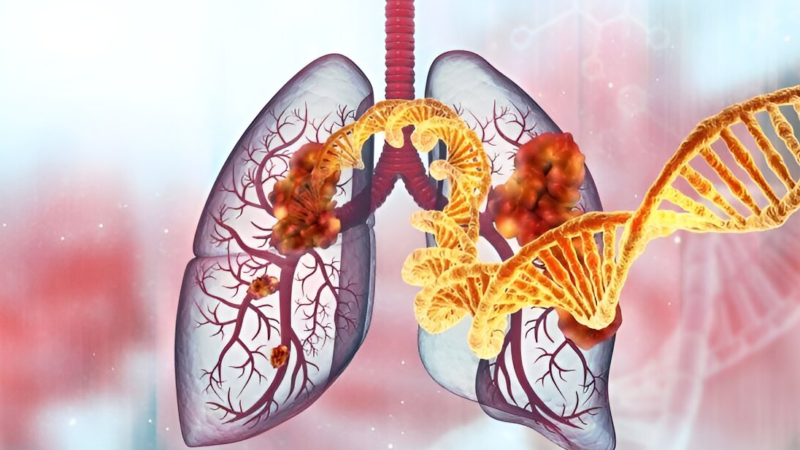 Understanding the Global burden of lung cancer: IARC’s research and prevention efforts