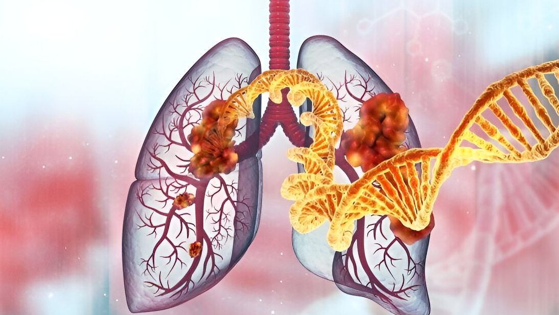 New research reveals why EGFR+ lung cancer treatments may fail over time – EGFR Positive UK