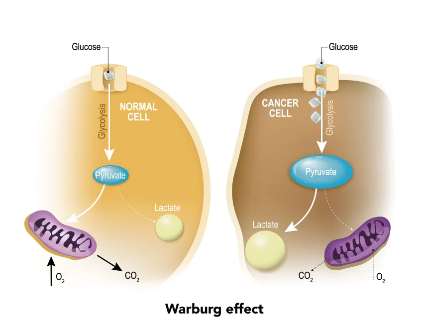 The Warburg effect and how cancer metabolism affects chemotherapy response