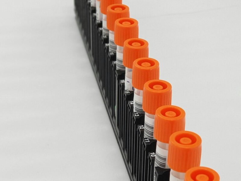 New study on overdiagnosis of prostate cancer in Europe – IARC