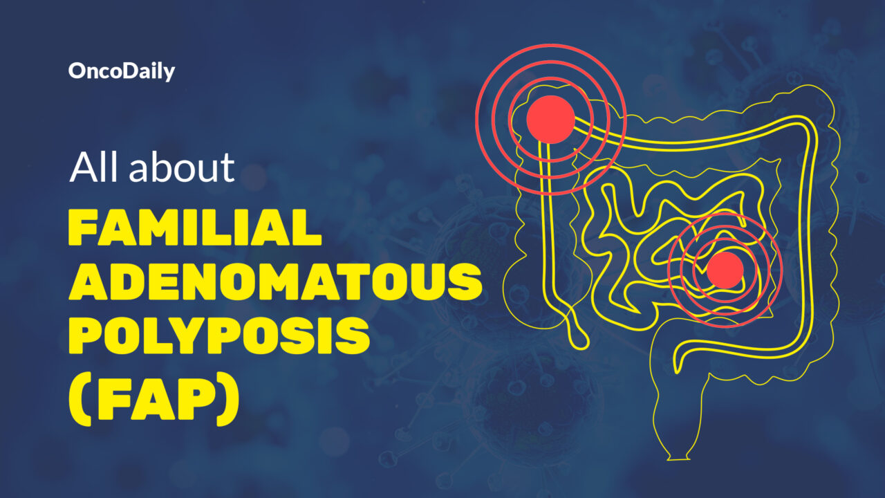 Familial Adenomatous Polyposis: Alarming Symptoms, Causes, Types, Diagnosis and Treatment