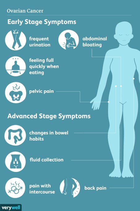 4 symptomes that can improve the diagnosis of ovarian cancer by Shahrin Ahmed