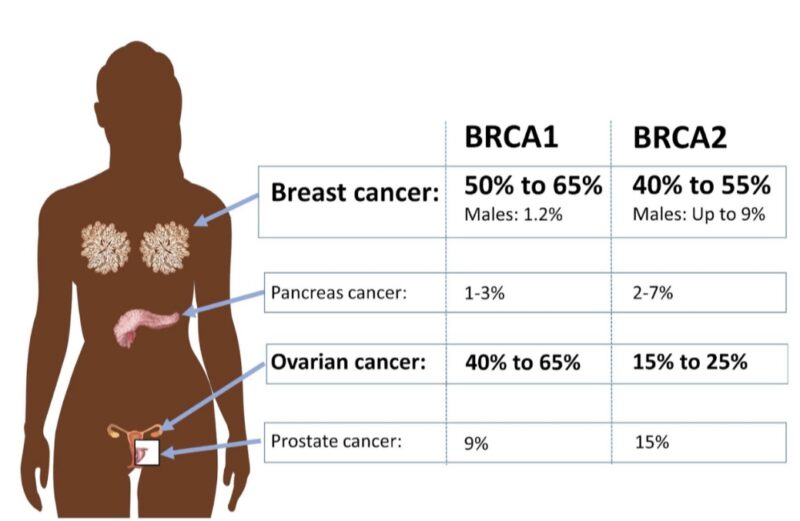 Breast Cancer genetic risk