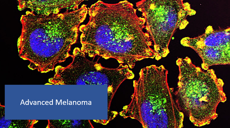 Ipilimumab or Relatlimab Plus Nivolumab in Advanced Melanoma