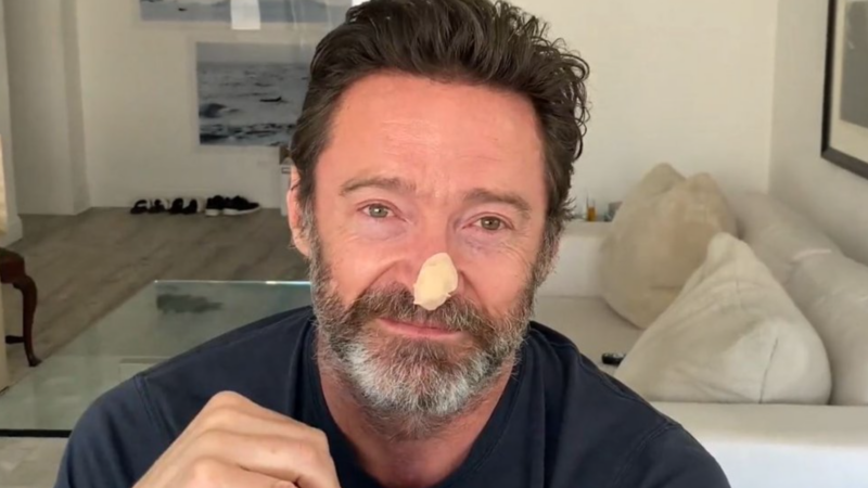 Hugh Jackman Skin Cancer