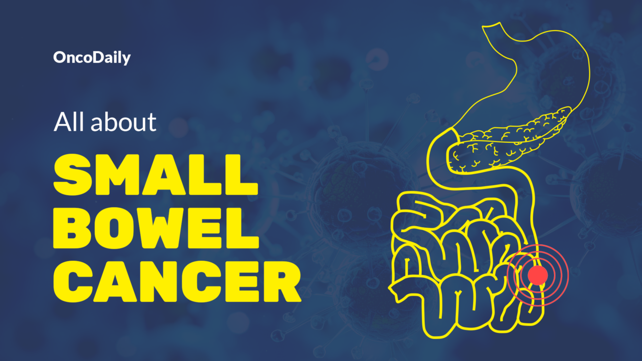 Small Bowel Cancer: Symptoms & Causes, Types, Diagnosis and Treatment