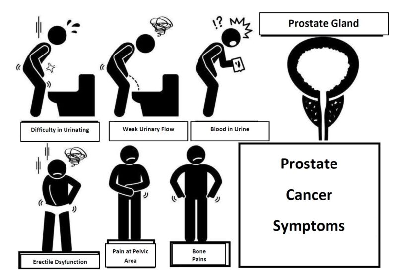 prostate cancer symptoms