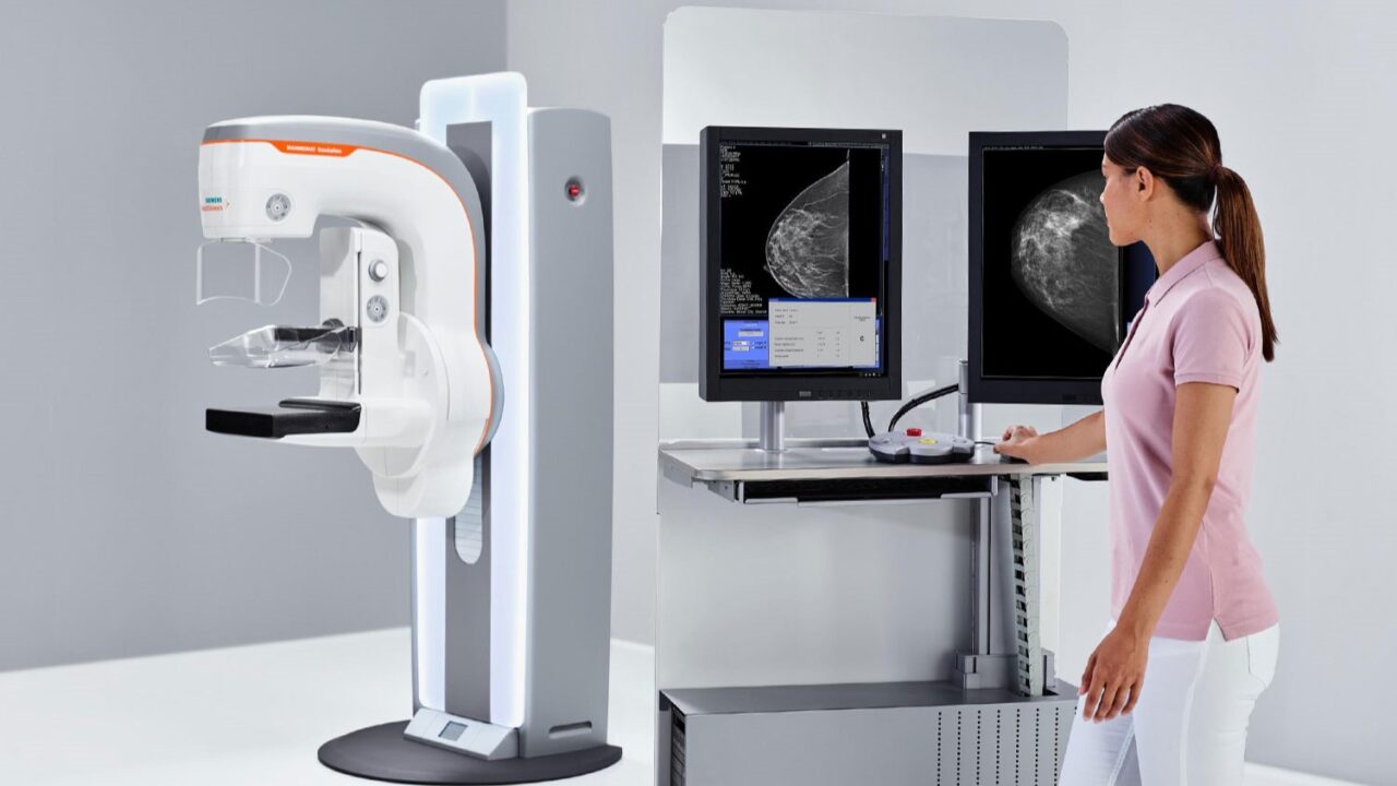 Francisco Esteva: Digital breast tomosynthesis, more effective in breast cancer screening than traditional digital mammography