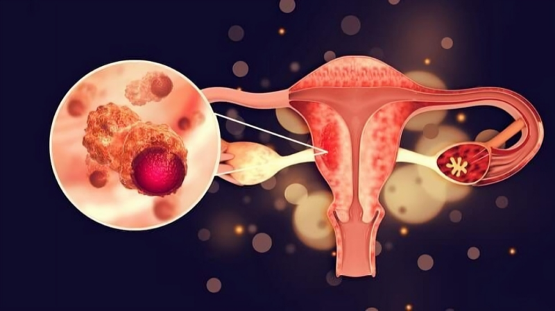 ovarian preservation 