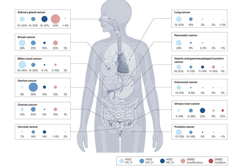 Francisco Esteva: HER2-targeted therapies are being explored for various other solid tumors