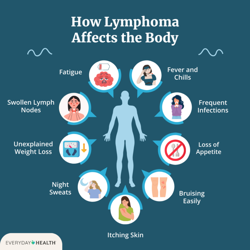 lymphoma symptoms