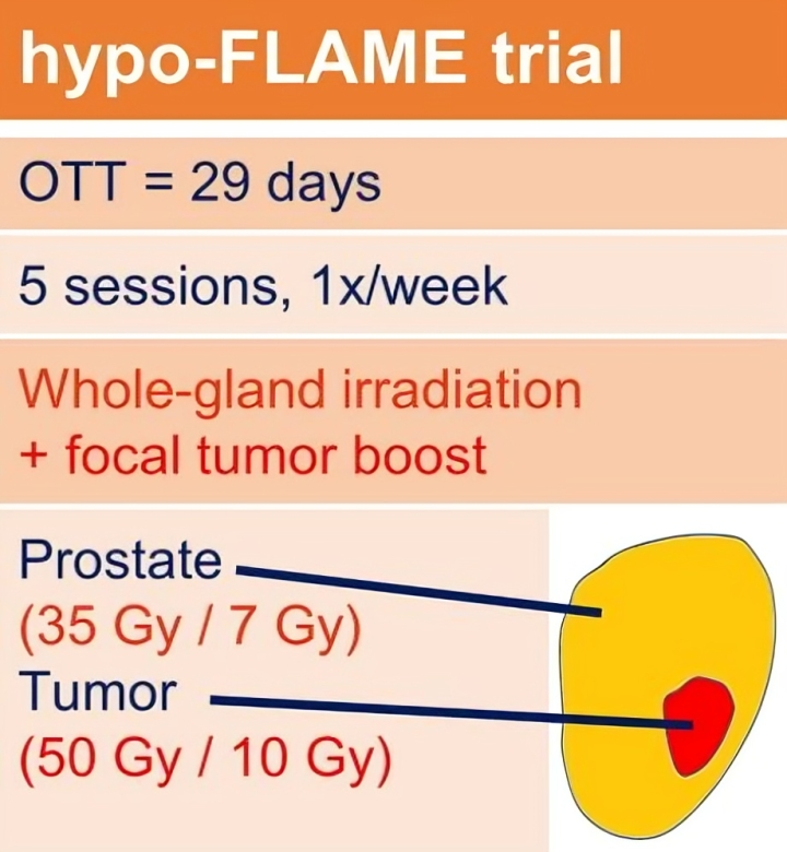 Gustavo Viani: Prostate SBRT with an integrated focal boost demonstrated excellent 5-year outcomes