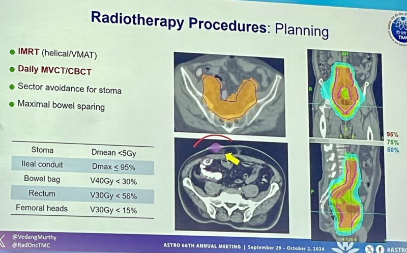 Vedang Murthy presented results of the phase III BART trial at ASTRO24