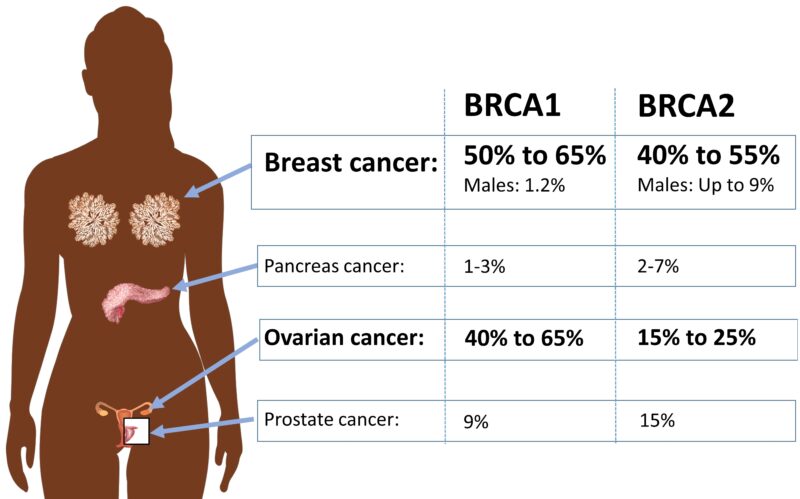 Breast Cancer Risks