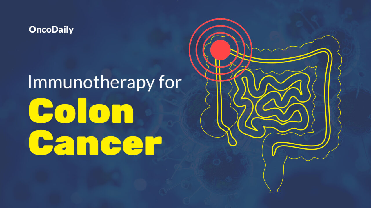 Immunotherapy for Colon Cancer: Types, Success Rate, Side Effects & More