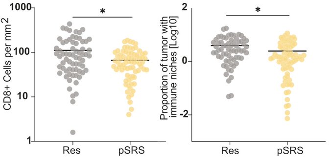 Carey Jansen: Pre-op SRS and the immune microenvironment of human brain metastases