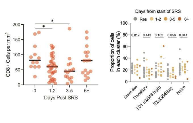 Carey Jansen: Pre-op SRS and the immune microenvironment of human brain metastases