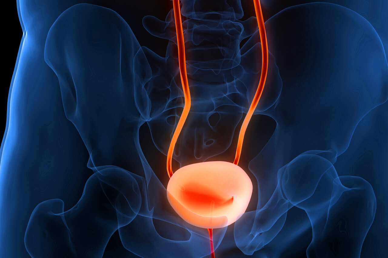 Molecular Subtypes Associated with Clinical Benefit in Cisplatin ...