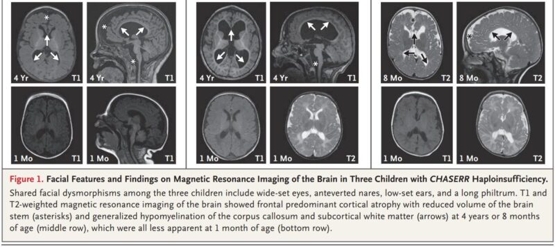 Biggest medical discoveries of the week suggested by Samuel Hume