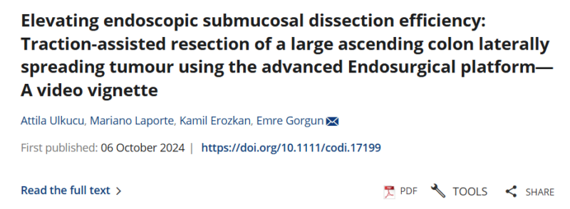 Attila Ulkucu: A breakthrough 49-minute traction-assisted ESD on a 70mm ascending colon tumor!