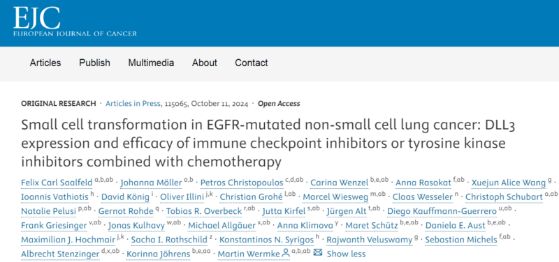 Retrospective report on EGFR mutant NSCLC transformed to SCLC, suggested by Stephen V Liu