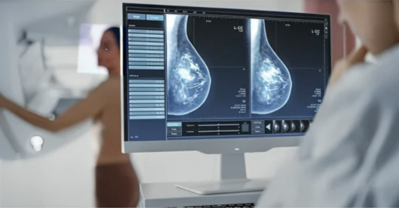 Explore breast cancer statistics on IARC’s Global Cancer Observatory – IARC/WHO